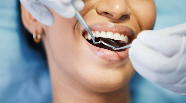 Best Emergency Dental Filling Replacement  in Allardt, TN